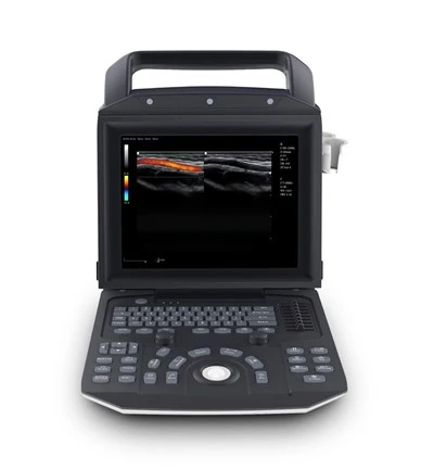 Zoncare M5 Color Doppler ултразвукова система за лаптоп
