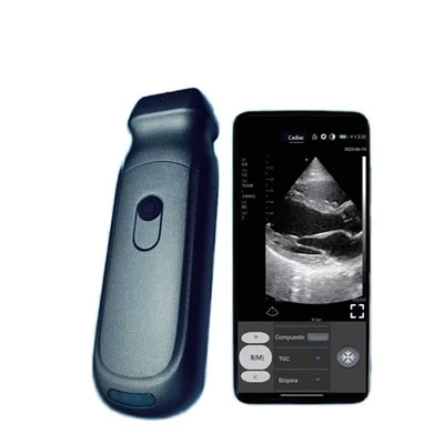 FTL-S9PA безжичен Mini UltraSound скенер с двойни сонди